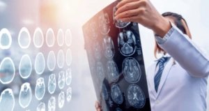 Brain Injuries image