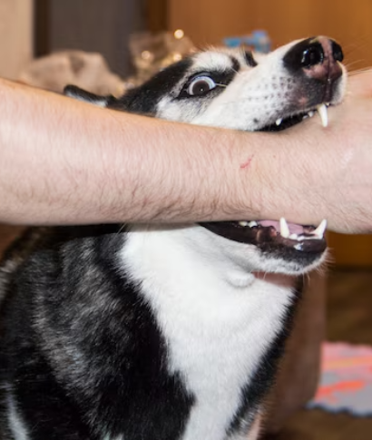 Dog Bite 
